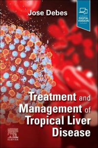 Treatment and Management of Tropical Liver Disease First Edition