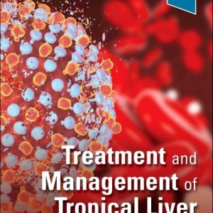 Treatment and Management of Tropical Liver Disease First Edition