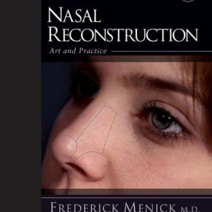 Nasal Reconstruction Art and Practice First Edition