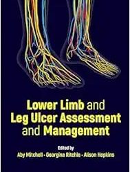 Lower Limb and Leg Ulcer Assessment and Management First Edition