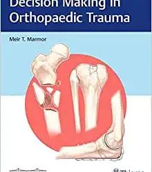 Decision Making in Orthopaedic Trauma First Edition
