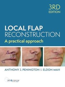 Local Flap Reconstruction A Practical Approach Third Edition