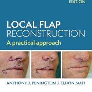 Local Flap Reconstruction A Practical Approach