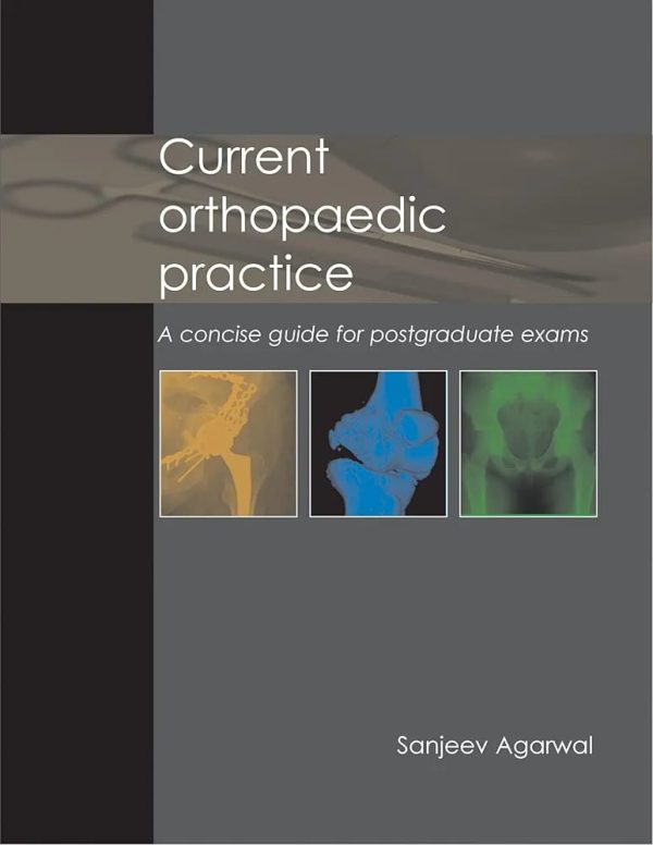 Current Orthopaedic Practice  A Concise Guide for Postgraduate Exams First Edition