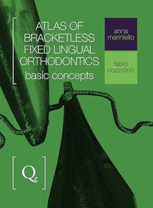Atlas of Bracketless Fixed Lingual Orthodontics First Edition