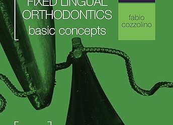Atlas of Bracketless Fixed Lingual Orthodontics First Edition