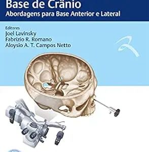 ABORL Práticas em Cirurgia da Base de Crânio Abordagens para Base Anterior e Lateral