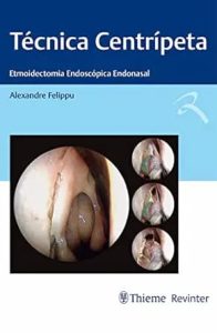 Técnica Centrípeta: Etmoidectomia Endoscópica Endonasal First Edition