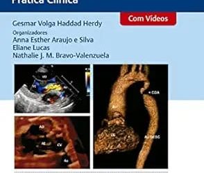 Cardiologia Pediátrica: Prática Clínica First Edition