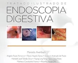 Tratado Ilustrado de Endoscopia Digestiva Seventh Edition