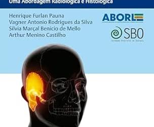 valiação do Osso Temporal por Imagem Uma Abordagem Radiológica e Histológica First Edition