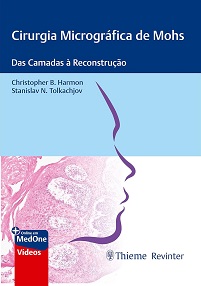 Cirurgia Micrográfica de Mohs: Das Camadas à Reconstrução First Edition