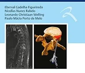 Condutas em Neurocirurgia Fundamentos Práticos  Coluna First Edition