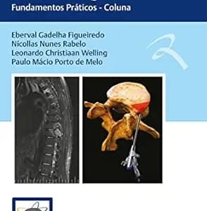 Condutas em Neurocirurgia Fundamentos Práticos  Coluna First Edition