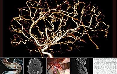 The Neuro ICU Board Review First Edition