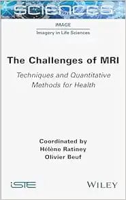 The Challenges of MRI: Techniques and Quantitative Methods for Health First Edition