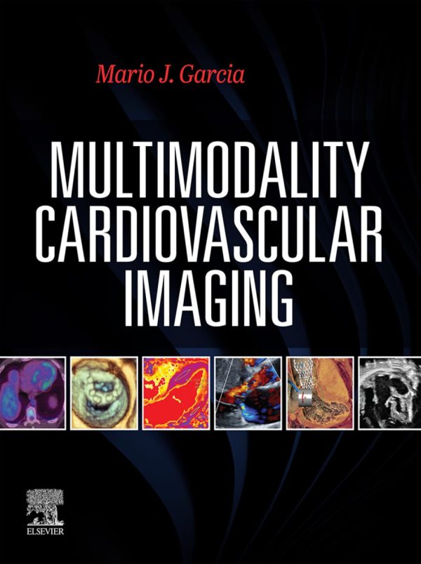 Multimodality Cardiovascular Imaging First Edition