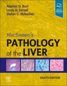MacSween’s Pathology of the Liver Eighth Edition