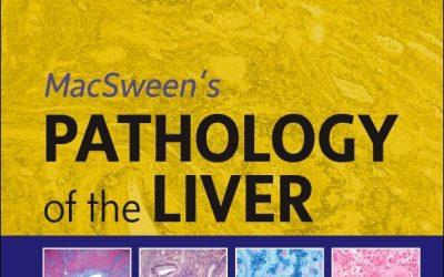 MacSween’s Pathology of the Liver Eighth Edition