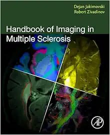 Handbook of Imaging in Multiple Sclerosis First Edition