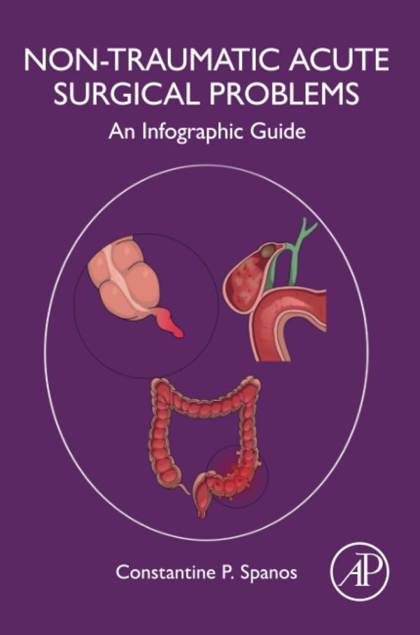 NonTraumatic Acute Surgical Problems An Infographic Guide First Edition