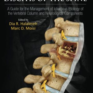 Osteomyelitis and Discitis of the Spine  A Guide for the Management of Infectious Etiology of the Vertebral Column and Neurological Components First Edition