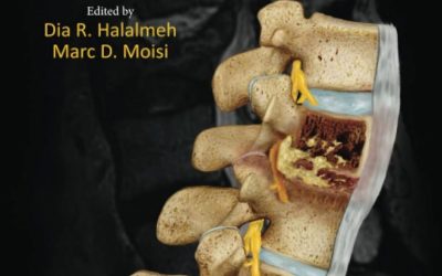 Osteomyelitis and Discitis of the Spine A Guide for the Management of Infectious Etiology of the Vertebral Column and Neurological Components First Edition