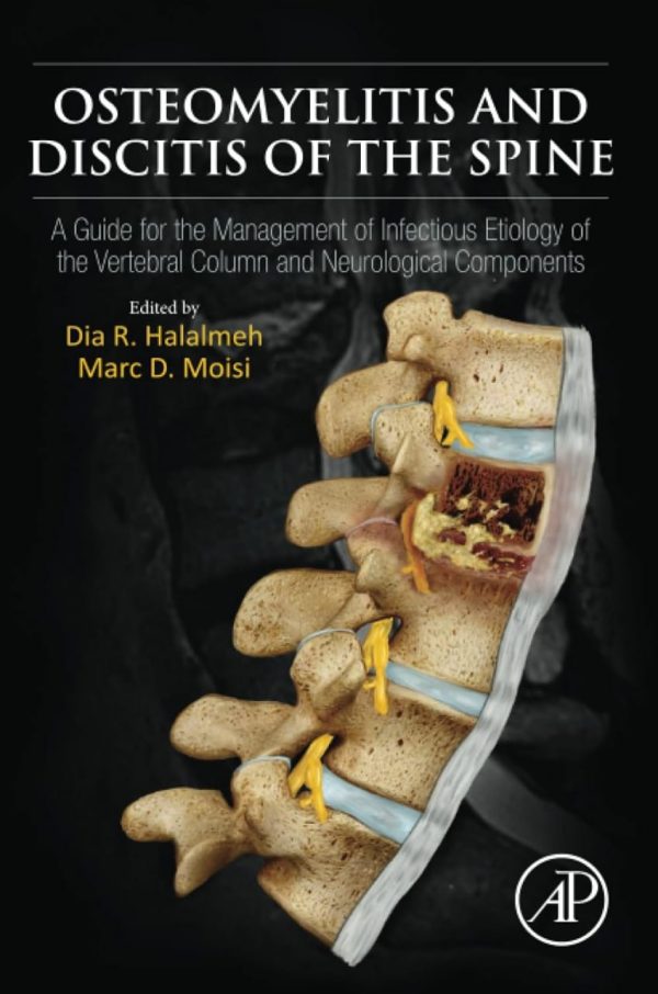 Osteomyelitis and Discitis of the Spine  A Guide for the Management of Infectious Etiology of the Vertebral Column and Neurological Components First Edition