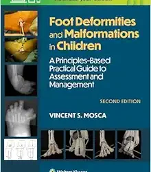 Foot Deformities and Malformations in Children: A Principles-Based, Practical Guide to Assessment and Management 2nd Edition
