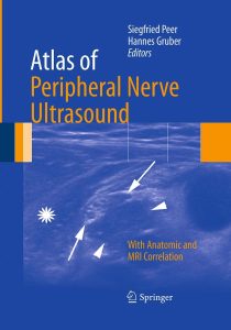 Atlas of Peripheral Nerve Ultrasound With Anatomic and MRI Correlation