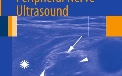 Atlas of Peripheral Nerve Ultrasound With Anatomic and MRI Correlation