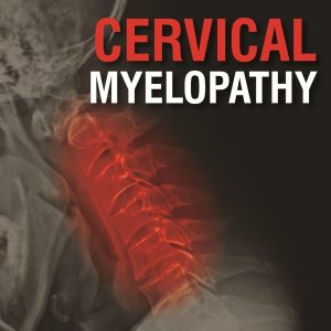 Cervical Myelopathy 1st Edition