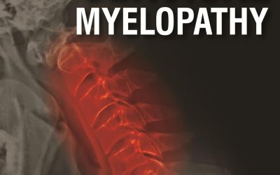 Cervical Myelopathy 1st Edition