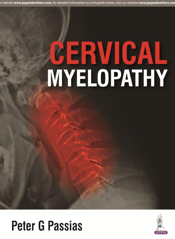 Cervical Myelopathy 1st Edition