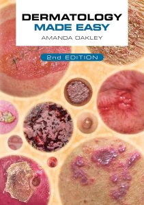 Dermatology Made Easy 2nd Edition