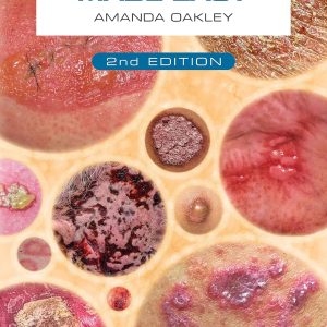 Dermatology Made Easy 2nd Edition