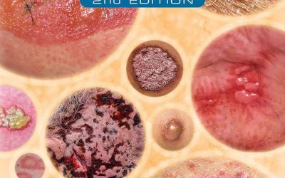 Dermatology Made Easy 2nd Edition