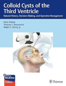 Instructor Resources of Colloid Cysts of the Third Ventricle: Natural History, Decision-Making, and Operative Management