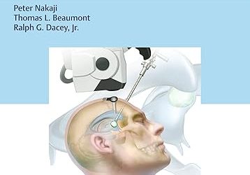 Instructor Resources of Colloid Cysts of the Third Ventricle: Natural History, Decision-Making, and Operative Management