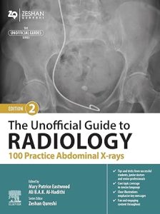 The Unofficial Guide to Radiology: 100 Practice Abdominal X-rays (Unofficial Guides), 2nd Edition