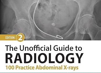 The Unofficial Guide to Radiology: 100 Practice Abdominal X-rays (Unofficial Guides), 2nd Edition