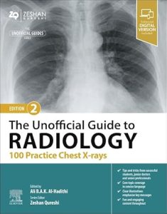 The Unofficial Guide to Radiology: 100 Practice Chest X-rays (Unofficial Guides), 2nd Edition