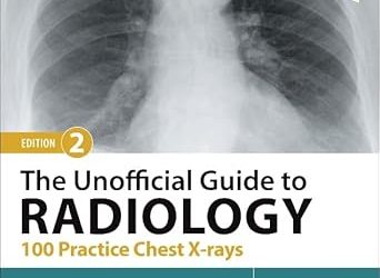 The Unofficial Guide to Radiology: 100 Practice Chest X-rays (Unofficial Guides), 2nd Edition