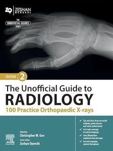 The Unofficial Guide to Radiology: 100 Practice Orthopaedic X-rays (Unofficial Guides), 2nd Edition