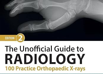 The Unofficial Guide to Radiology: 100 Practice Orthopaedic X-rays (Unofficial Guides), 2nd Edition