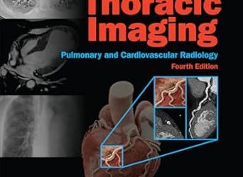 Webb & Higgins Thoracic Imaging 4th Edition