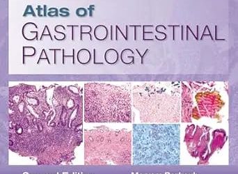 Atlas of Gastrointestinal Pathology A Pattern Based Approach to Non Neoplastic Biopsies Second Edition