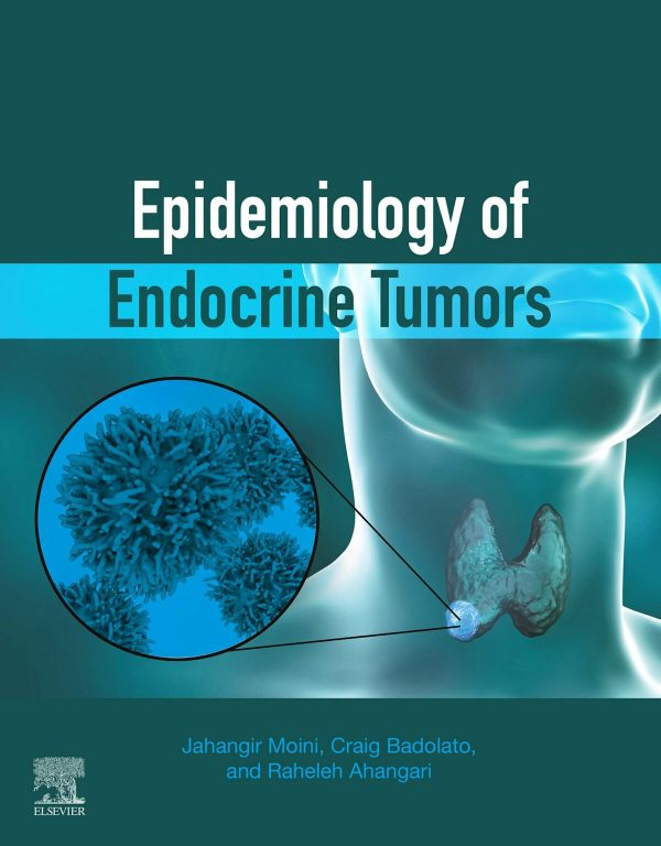 Epidemiology of Endocrine Tumors First Edition