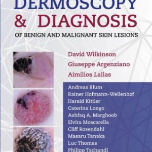 Dermoscopy And Diagnosis Of Benign and Malignant Skin Lesions First Edition