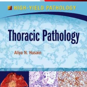 Thoracic Pathology A Volume in the High Yield Pathology Series First Edition